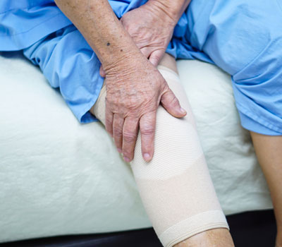 Leg injury & chronic wounds on an old person